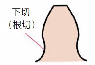 根切 根切